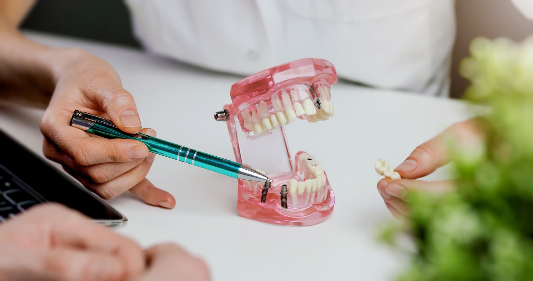 centro implantológico dental en Ourense