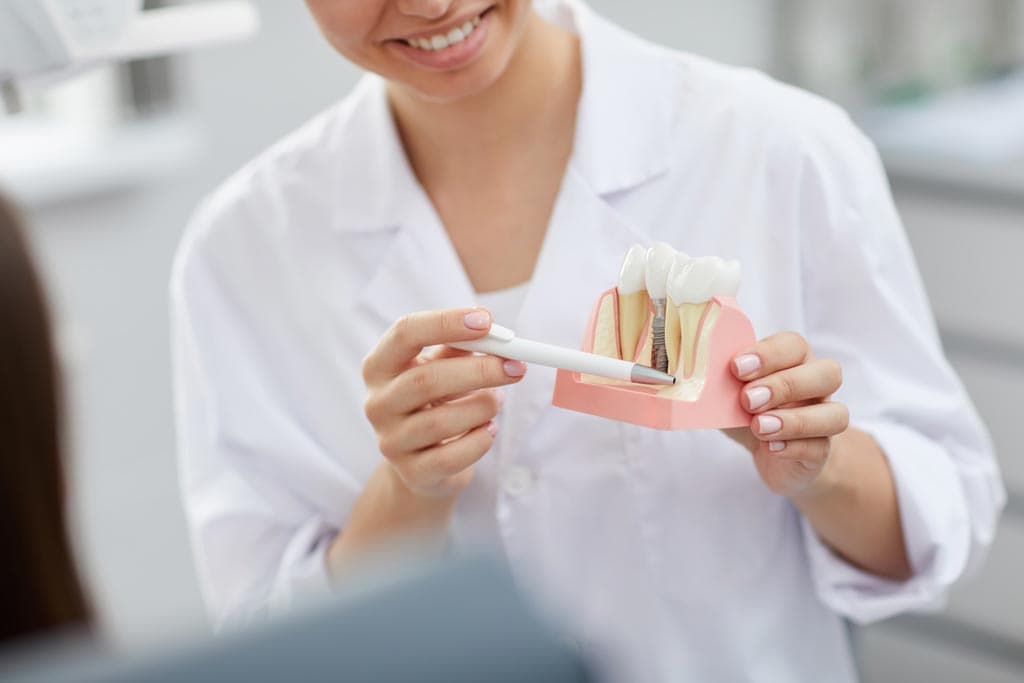 ¿Cuáles son las ventajas de los implantes dentales?