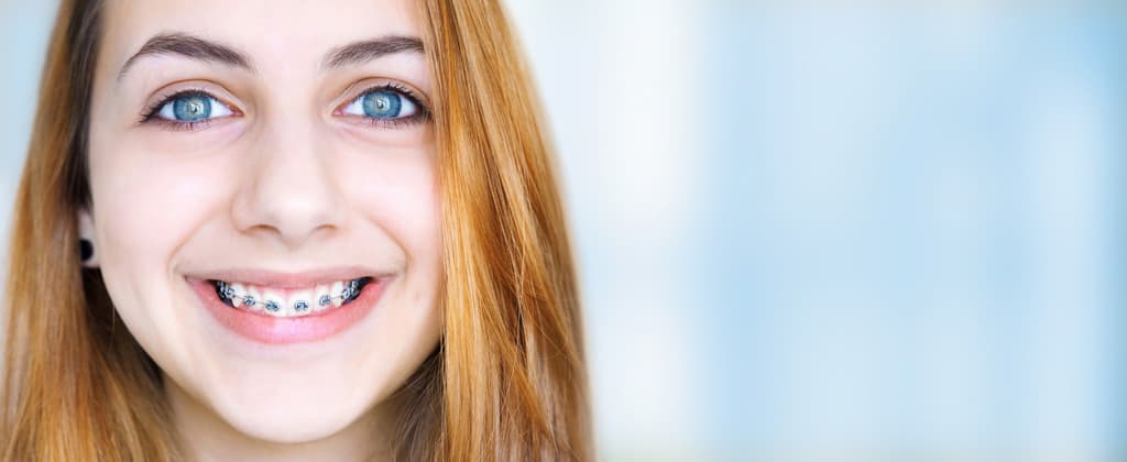 Encuentra el tratamiento de ortodoncia adecuado para ti
