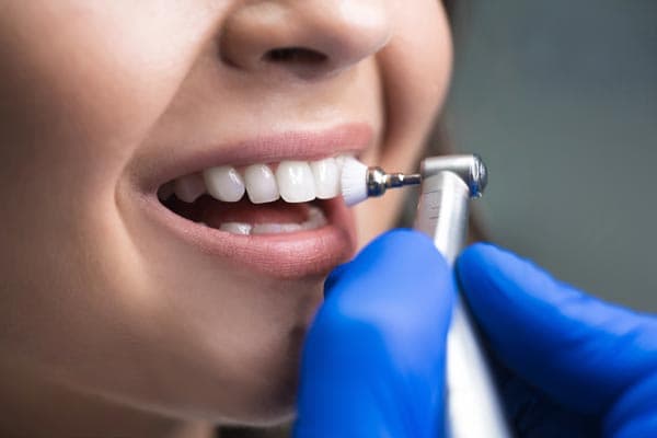 Fundas dentales