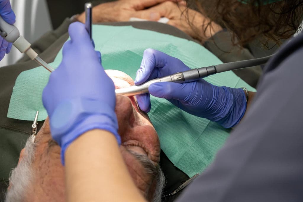 Tratamientos de periodoncia